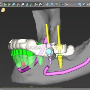 codiagnostix 10.6