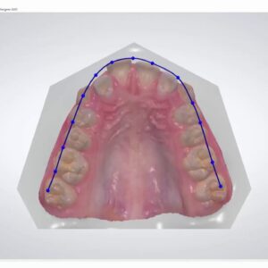 cracked ortho