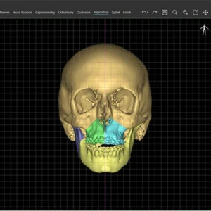 Materialise Mimics Enlight CMF 2025