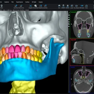 romexis 6.4.7 AI latest